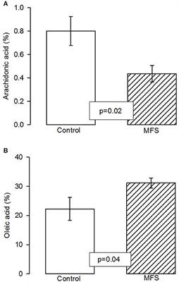 Participation of Arachidonic Acid Metabolism in the Aortic Aneurysm Formation in Patients with Marfan Syndrome